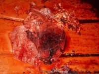 2400fps lungs.jpg