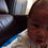 Crosseyed Baby