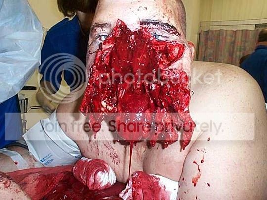 Face%20injury.jpg