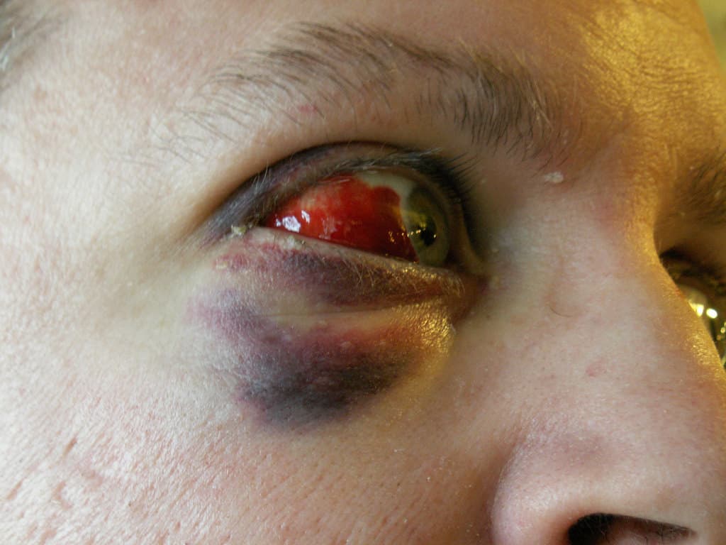 Scope-Bite.jpg